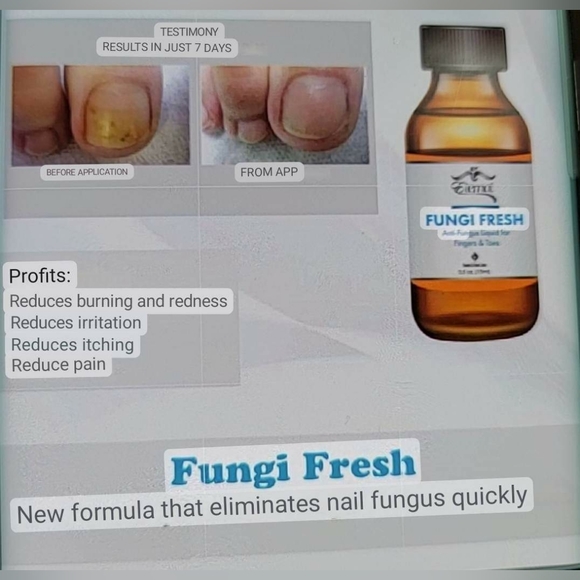 Fungi Freh/ Anti-Fungus EternalSpiritBeauty - Picture 10 of 10